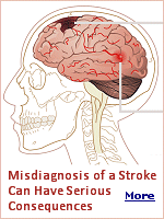 A stroke is a serious medical condition that is caused by an obstruction in the flow of oxygen-rich blood to the brain, or by a ruptures or leakage from arteries in the brain. When the brain is deprived of oxygen, even for a few moments, it can cause brain cells to die quickly. When this happens, the victim may experience symptoms in the areas of the body that are controlled by the damaged or destroyed brain cells. Proper emergency medical attention is vital following a stroke, and every second counts.